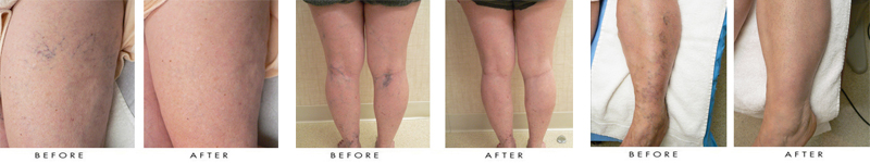 newportbeachmedspa