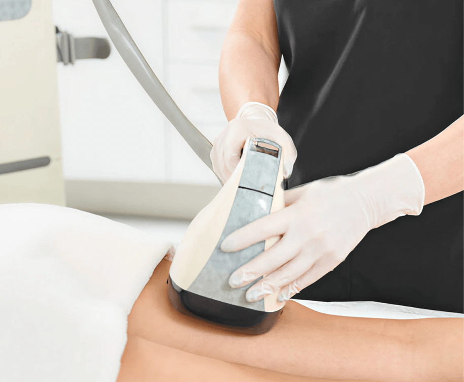 VelaShape 3 Treatment