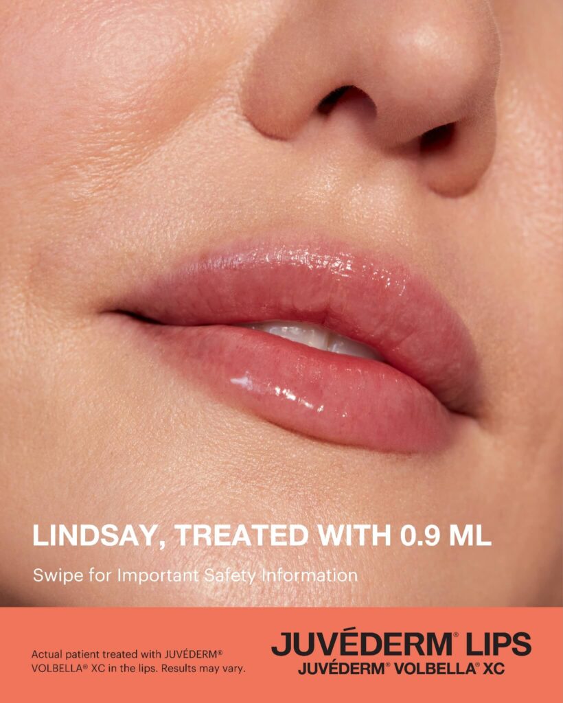 Juvederm: The Hyaluronic Acid Hydrator