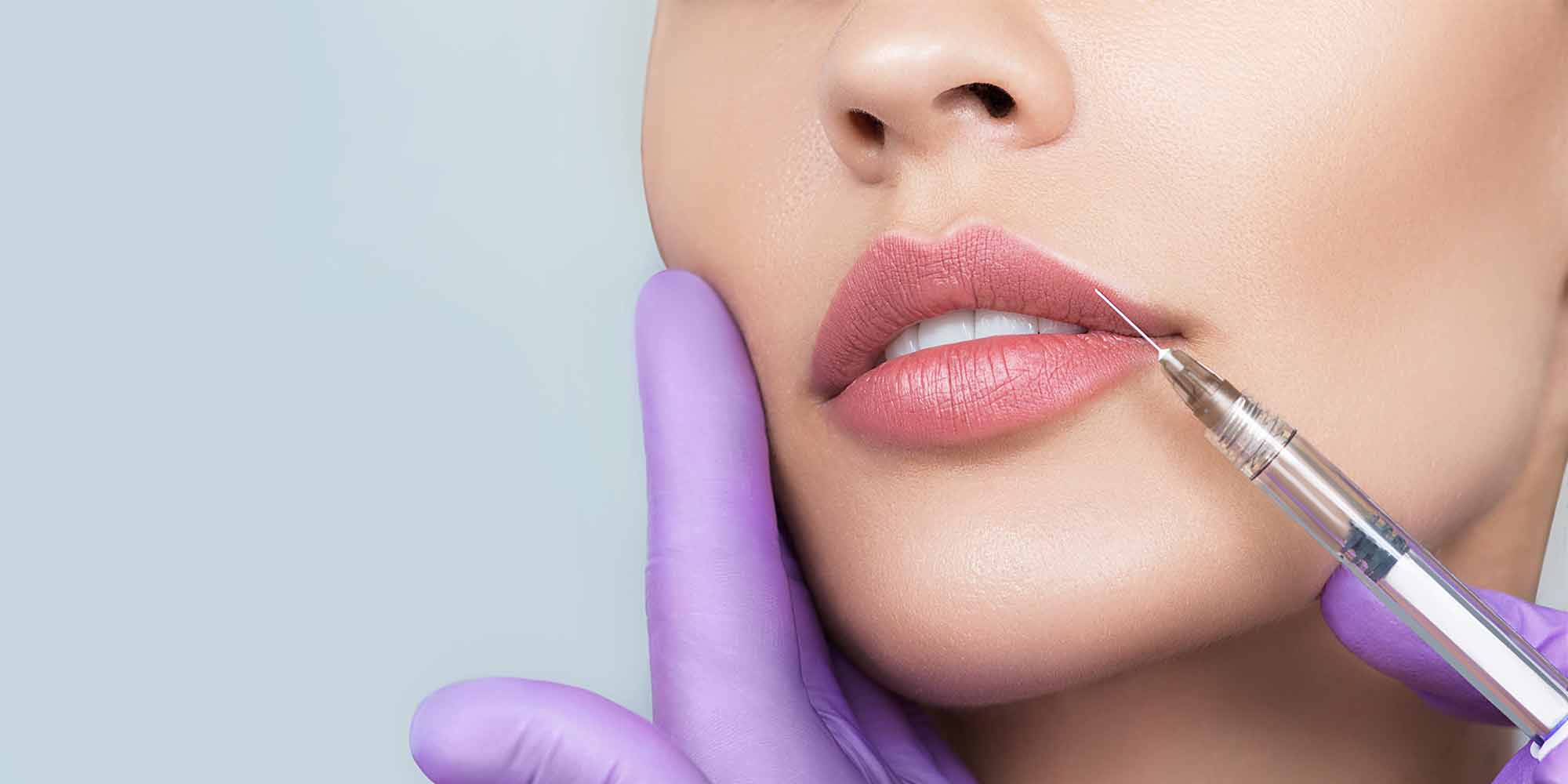 Lip Filler